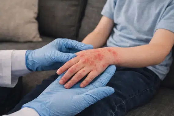 Alergólogo pediátrico trata dermatitis alérgica de un niño en su casa